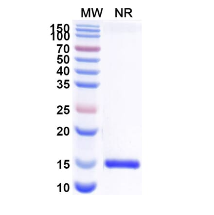 SDS-PAGE - Anti-Nectin 2 Nanobody [SAA2117] (A338322) - Antibodies.com