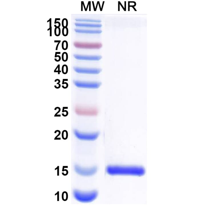 SDS-PAGE - Anti-Nectin 2 Nanobody [SAA2117] (A338322) - Antibodies.com