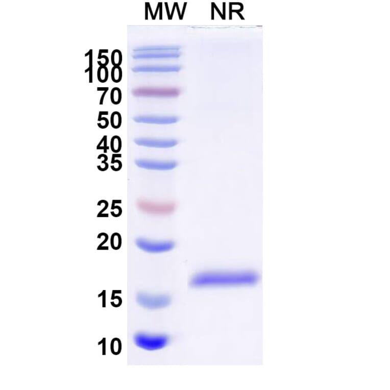 SDS-PAGE - Anti-Nectin 2 Nanobody [SAA2117] (A338322) - Antibodies.com