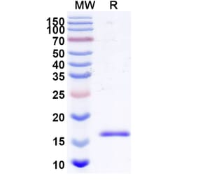 SDS-PAGE - Anti-Bax Nanobody [SAA2133] (A338323) - Antibodies.com