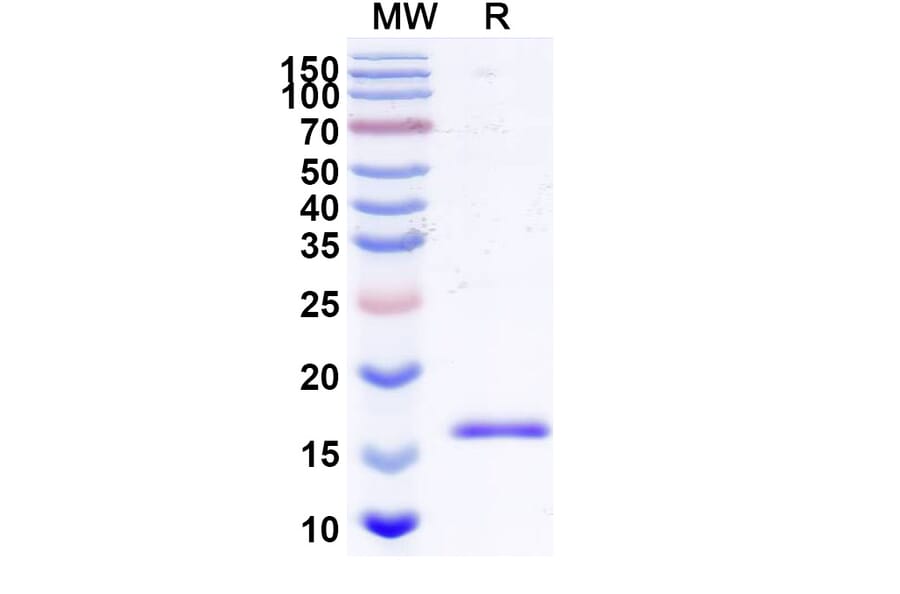 SDS-PAGE - Anti-Bax Nanobody [SAA2133] (A338323) - Antibodies.com