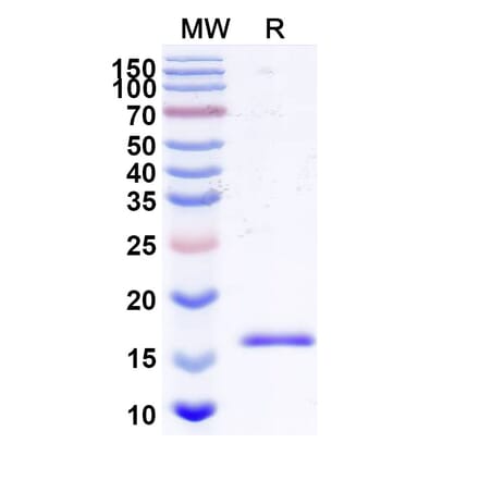SDS-PAGE - Anti-Bax Nanobody [SAA2133] (A338323) - Antibodies.com
