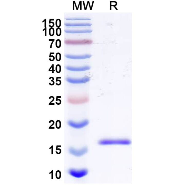 SDS-PAGE - Anti-Bax Nanobody [SAA2133] (A338323) - Antibodies.com