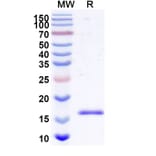 SDS-PAGE - Anti-Bax Nanobody [SAA2133] (A338323) - Antibodies.com