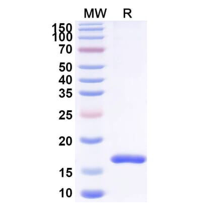 SDS-PAGE - Anti-CD16 Nanobody [SAA2149] (A338324) - Antibodies.com
