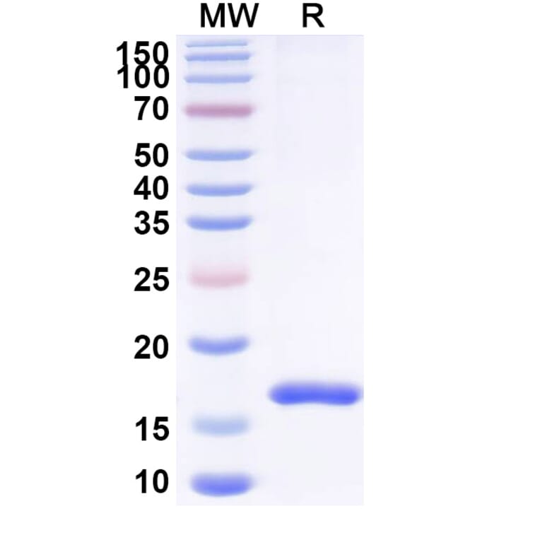 SDS-PAGE - Anti-CD16 Nanobody [SAA2149] (A338324) - Antibodies.com