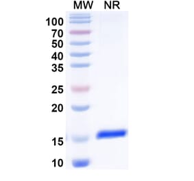 SDS-PAGE - Anti-CD32 Nanobody [SAA2150] (A338325) - Antibodies.com