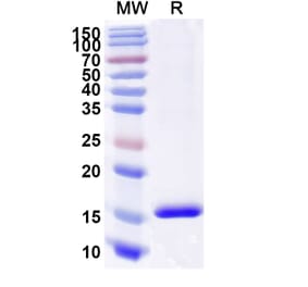 SDS-PAGE - Anti-CD89 Nanobody [SAA2151] (A338326) - Antibodies.com