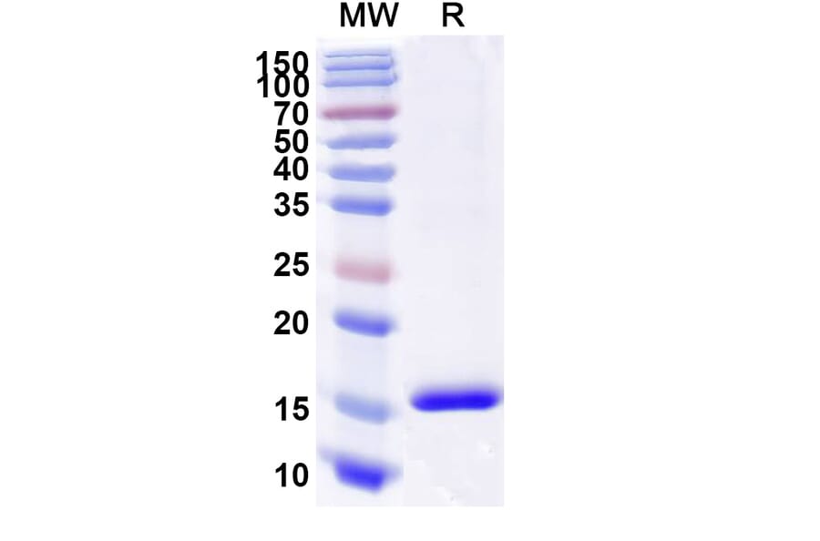 SDS-PAGE - Anti-CD89 Nanobody [SAA2151] (A338326) - Antibodies.com