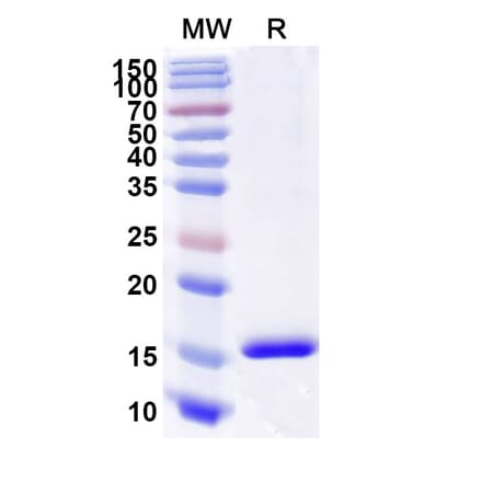 SDS-PAGE - Anti-CD89 Nanobody [SAA2151] (A338326) - Antibodies.com