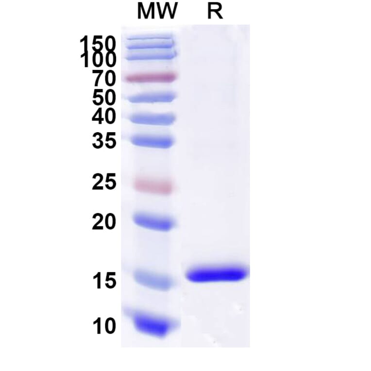 SDS-PAGE - Anti-CD89 Nanobody [SAA2151] (A338326) - Antibodies.com