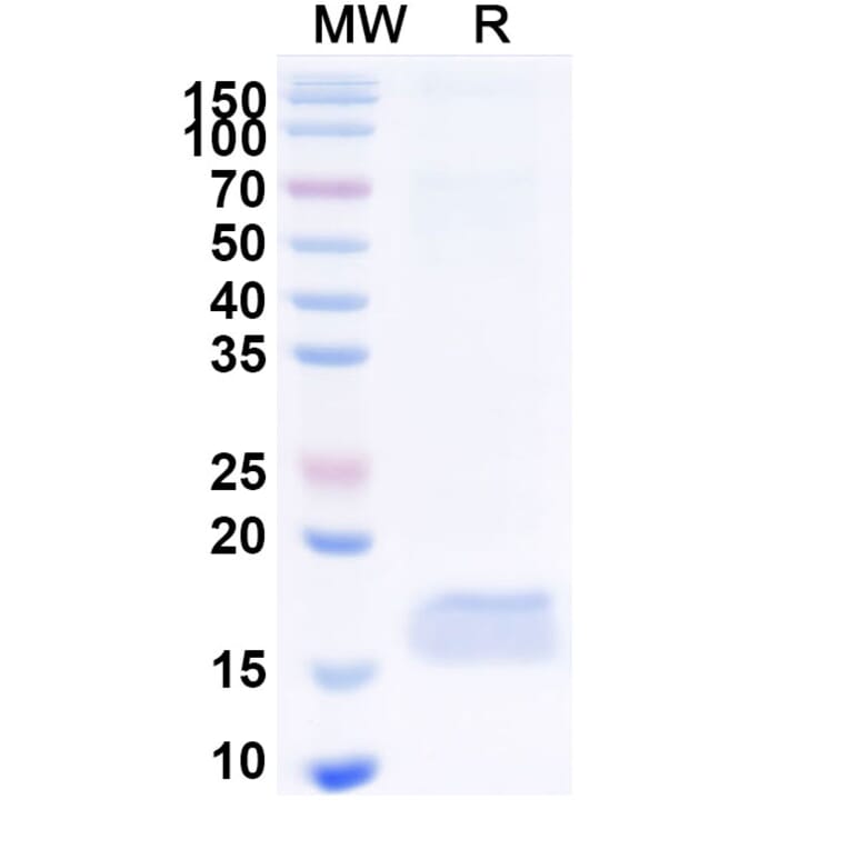 SDS-PAGE - Anti-CD89 Nanobody [SAA2151] (A338326) - Antibodies.com