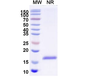 SDS-PAGE - Anti-CD64 Nanobody [SAA2152] (A338327) - Antibodies.com