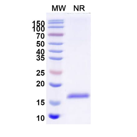 SDS-PAGE - Anti-CD64 Nanobody [SAA2152] (A338327) - Antibodies.com