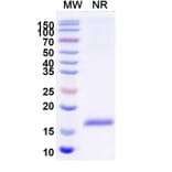 SDS-PAGE - Anti-CD64 Nanobody [SAA2152] (A338327) - Antibodies.com