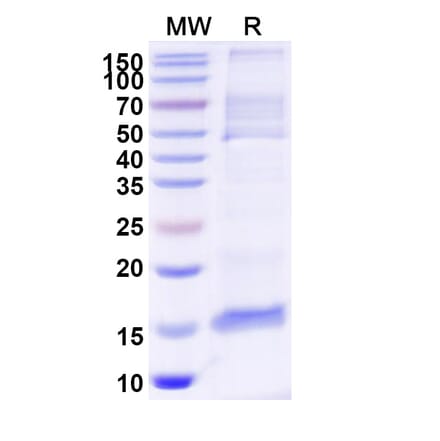 SDS-PAGE - Anti-Tau Nanobody [2C5] (A338328) - Antibodies.com