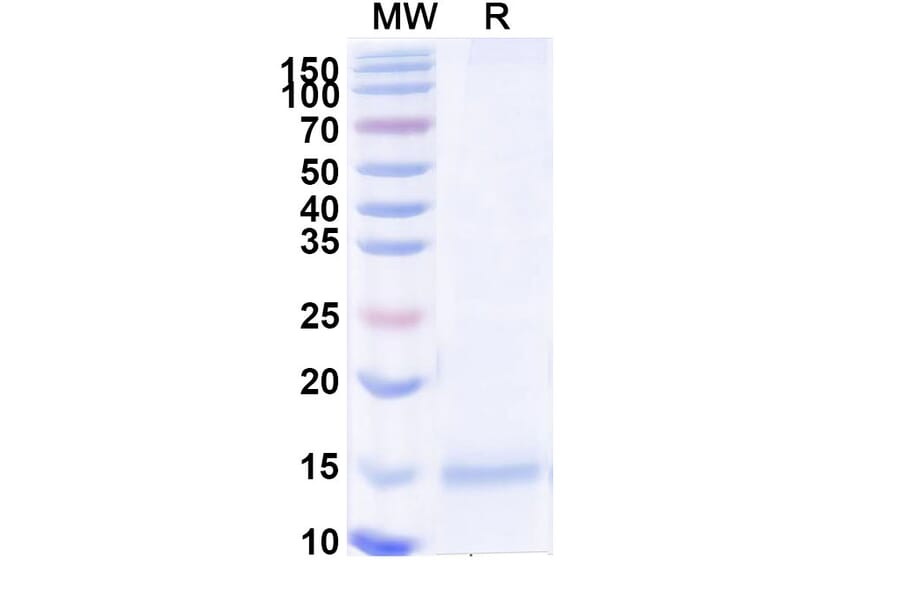 SDS-PAGE - Anti-Tau Nanobody [2C5] (A338328) - Antibodies.com
