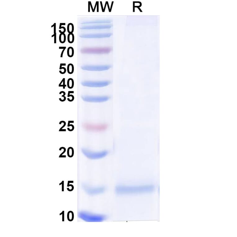 SDS-PAGE - Anti-Tau Nanobody [2C5] (A338328) - Antibodies.com