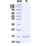 SDS-PAGE - Anti-Tau Nanobody [2C5] (A338328) - Antibodies.com