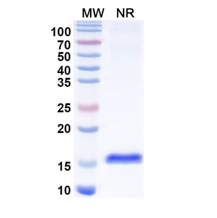 SDS-PAGE - Anti-Tau Nanobody [SAA2138] (A338329) - Antibodies.com