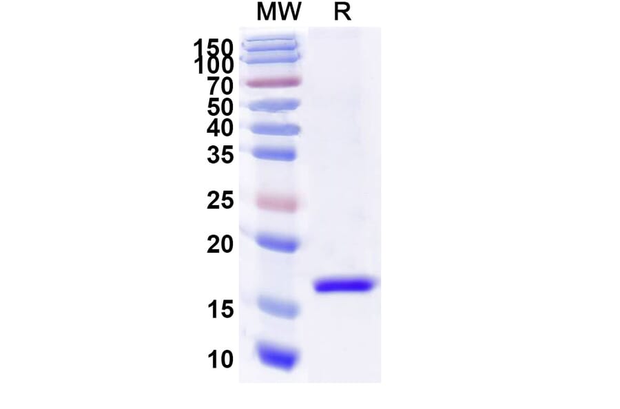 SDS-PAGE - Anti-Tau Nanobody [SAA2138] (A338329) - Antibodies.com