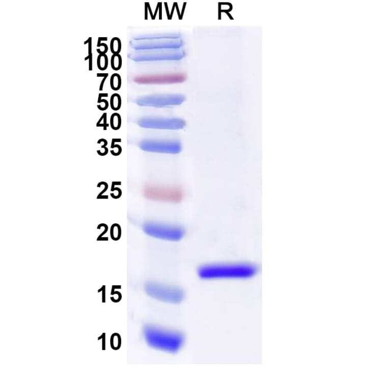 SDS-PAGE - Anti-Tau Nanobody [SAA2138] (A338329) - Antibodies.com
