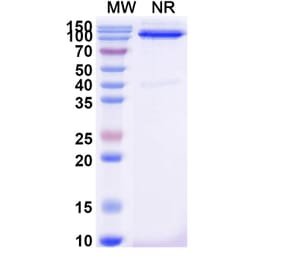 SDS-PAGE - Anti-CD31 Nanobody [SAA2178] (A338330) - Antibodies.com