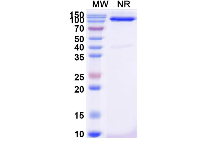 SDS-PAGE - Anti-CD31 Nanobody [SAA2178] (A338330) - Antibodies.com