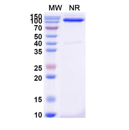 SDS-PAGE - Anti-CD31 Nanobody [SAA2178] (A338330) - Antibodies.com