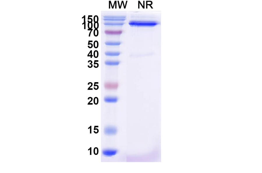 SDS-PAGE - Anti-CD31 Nanobody [SAA2178] (A338330) - Antibodies.com