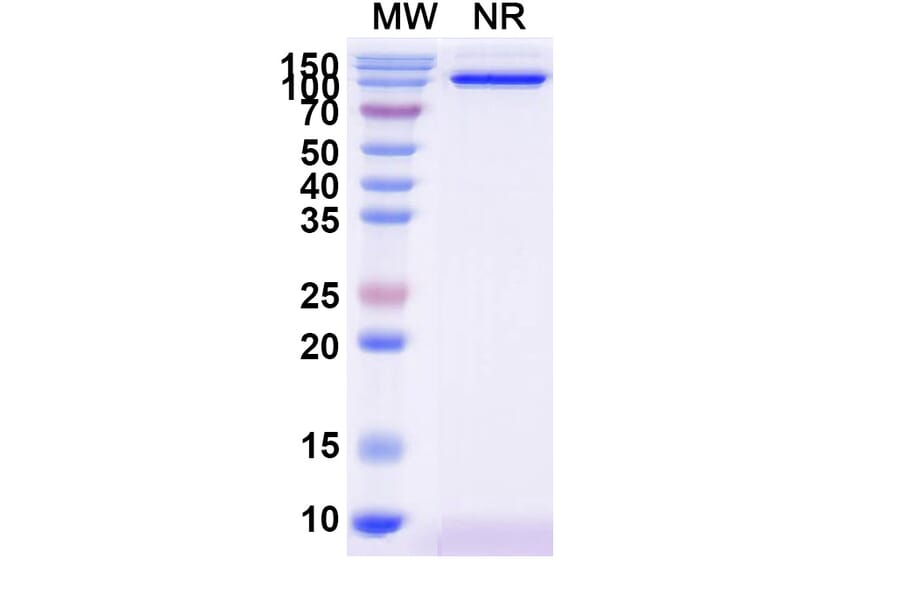 SDS-PAGE - Anti-CD31 Nanobody [SAA2179] (A338331) - Antibodies.com