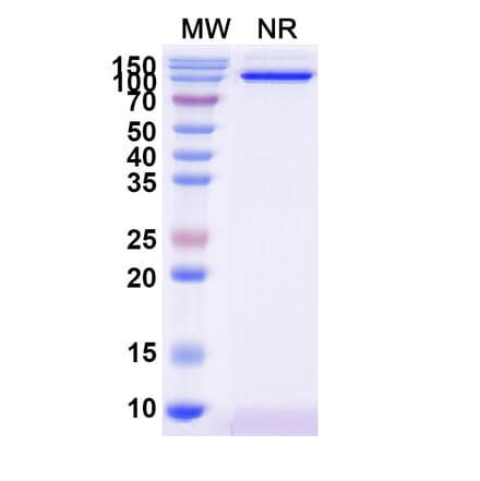 SDS-PAGE - Anti-CD31 Nanobody [SAA2179] (A338331) - Antibodies.com