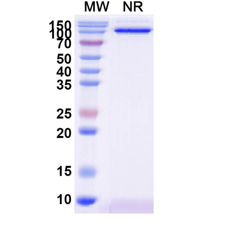 SDS-PAGE - Anti-CD31 Nanobody [SAA2179] (A338331) - Antibodies.com