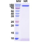 SDS-PAGE - Anti-CD31 Nanobody [SAA2179] (A338331) - Antibodies.com