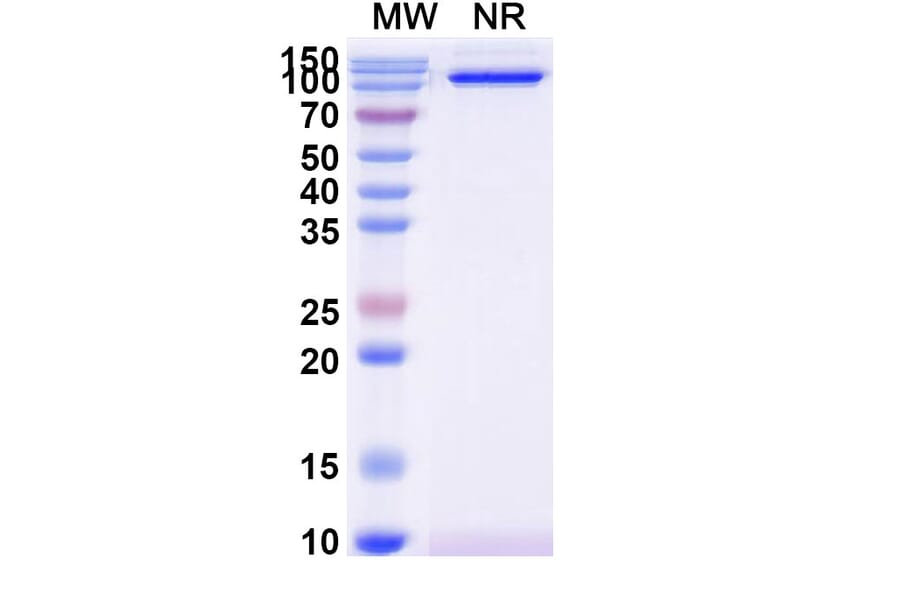 SDS-PAGE - Anti-CD31 Nanobody [SAA2179] (A338331) - Antibodies.com