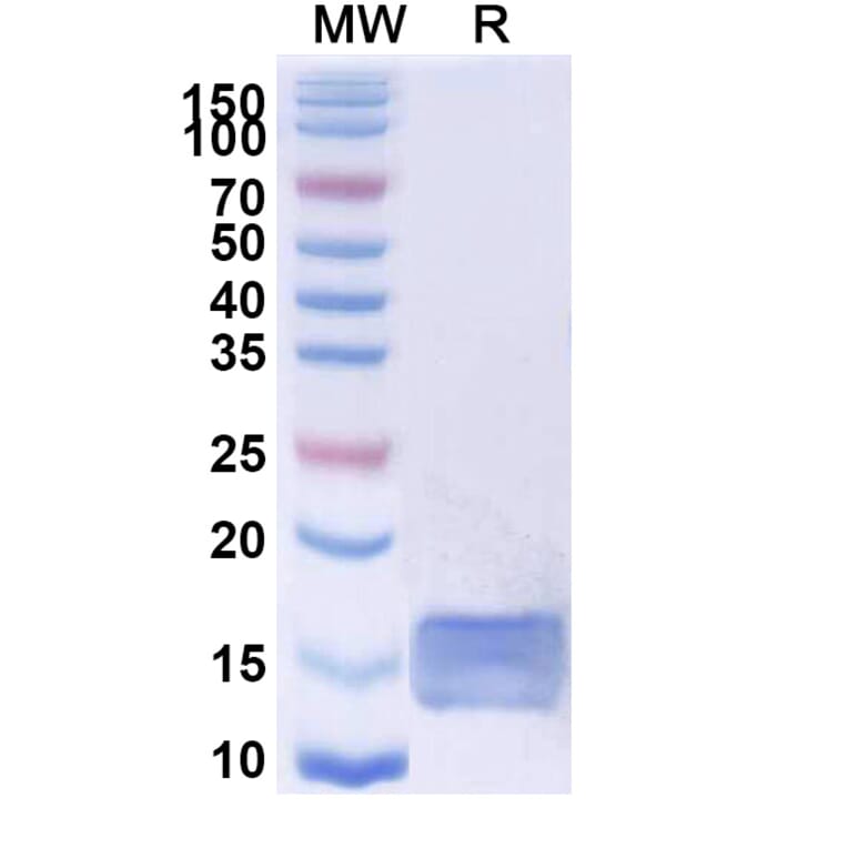 SDS-PAGE - Anti-SARS-CoV-2 Spike Protein RBD Nanobody [VHH-72] (A338332) - Antibodies.com