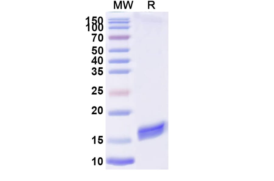 SDS-PAGE - Anti-SARS-CoV-2 Spike Protein RBD Nanobody [H11-D4] (A338333) - Antibodies.com