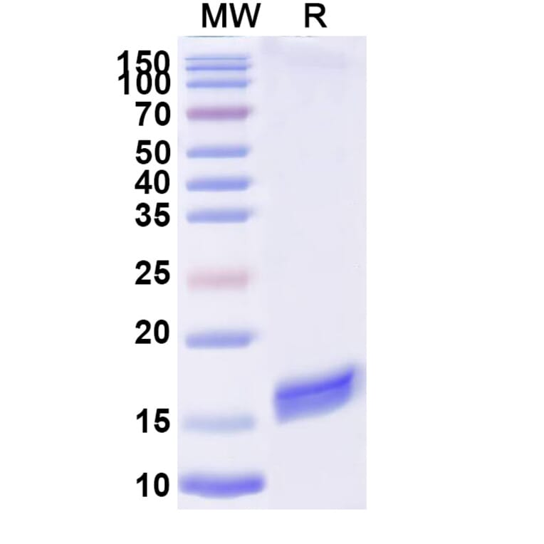 SDS-PAGE - Anti-SARS-CoV-2 Spike Protein RBD Nanobody [H11-D4] (A338333) - Antibodies.com