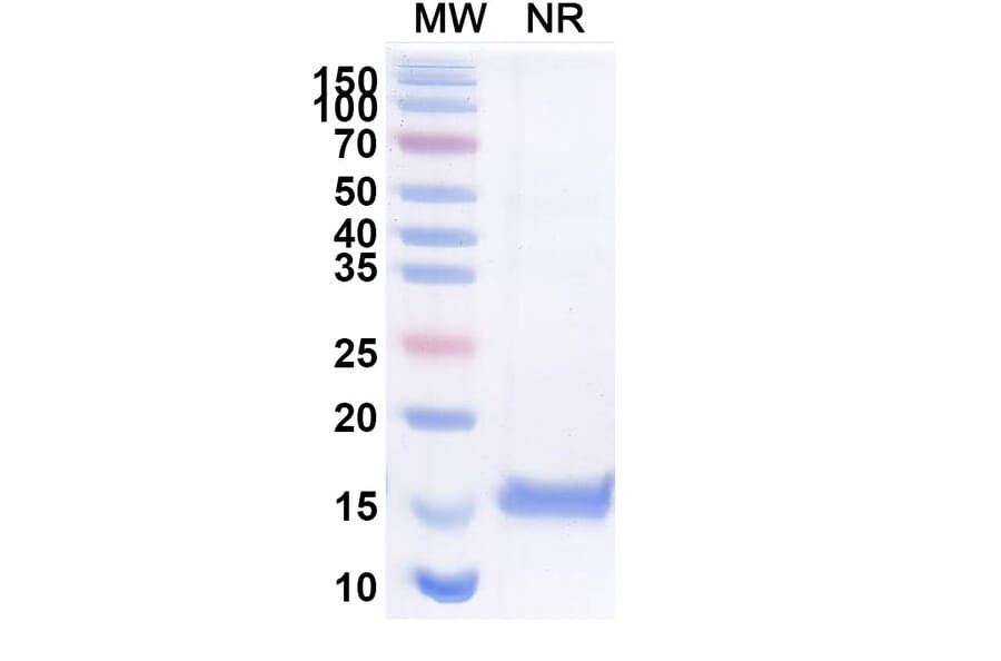 SDS-PAGE - Anti-SARS-CoV-2 Spike Protein RBD Nanobody [H11-H4] (A338334) - Antibodies.com