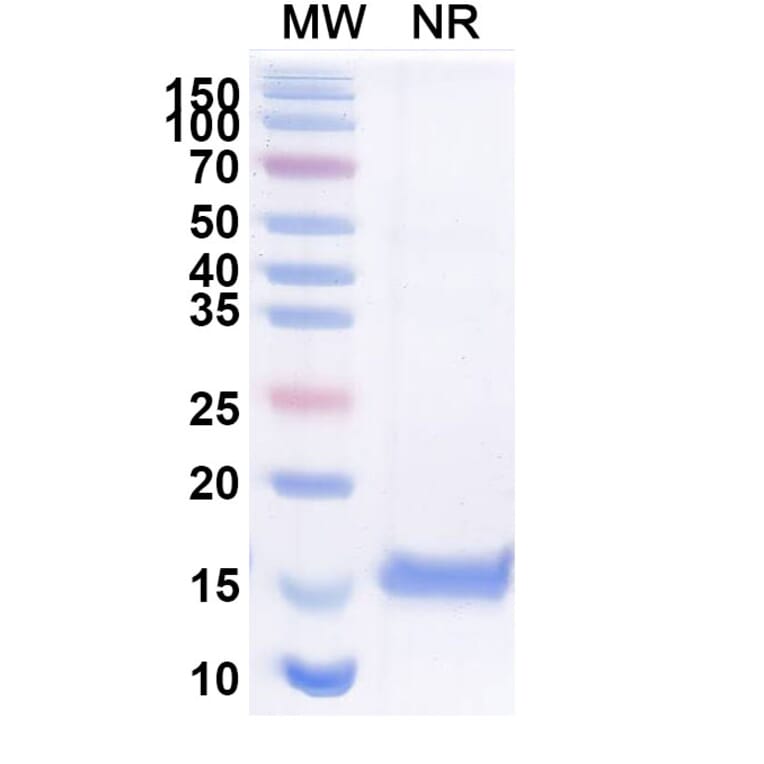 SDS-PAGE - Anti-SARS-CoV-2 Spike Protein RBD Nanobody [H11-H4] (A338334) - Antibodies.com