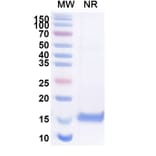 SDS-PAGE - Anti-SARS-CoV-2 Spike Protein RBD Nanobody [H11-H4] (A338334) - Antibodies.com