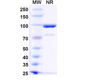SDS-PAGE - Anti-RANKL Nanobody [7C6] (A338335) - Antibodies.com