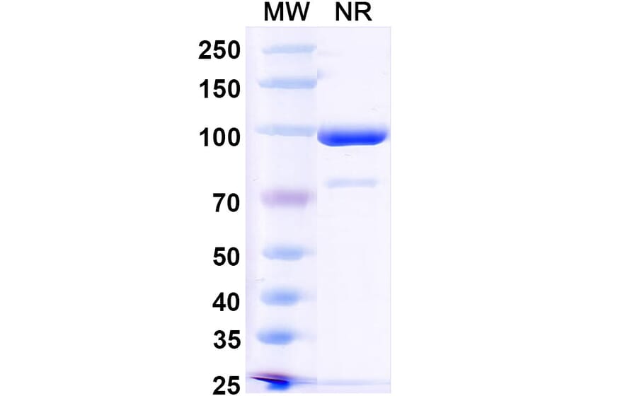 SDS-PAGE - Anti-RANKL Nanobody [7C6] (A338335) - Antibodies.com