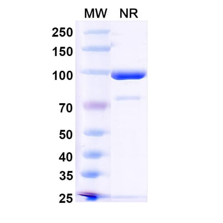 SDS-PAGE - Anti-RANKL Nanobody [7C6] (A338335) - Antibodies.com