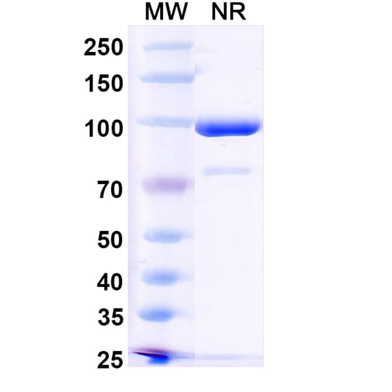 SDS-PAGE - Anti-RANKL Nanobody [7C6] (A338335) - Antibodies.com