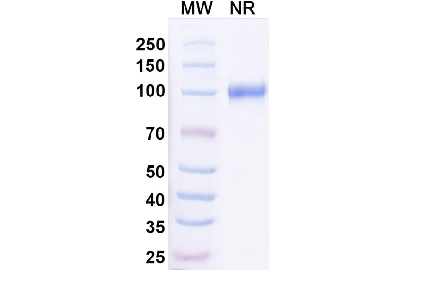 SDS-PAGE - Anti-RANKL Nanobody [7C6] (A338335) - Antibodies.com