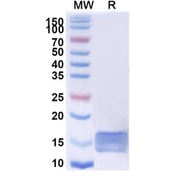 SDS-PAGE - Anti-CD45 Nanobody [2H5] (A338336) - Antibodies.com