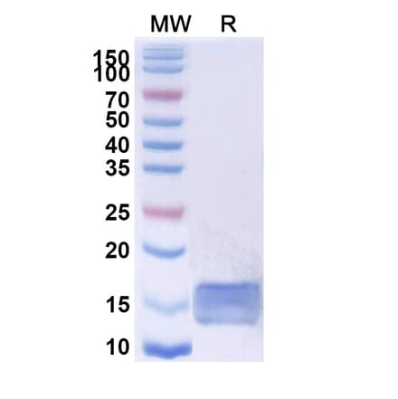 SDS-PAGE - Anti-CD45 Nanobody [2H5] (A338336) - Antibodies.com