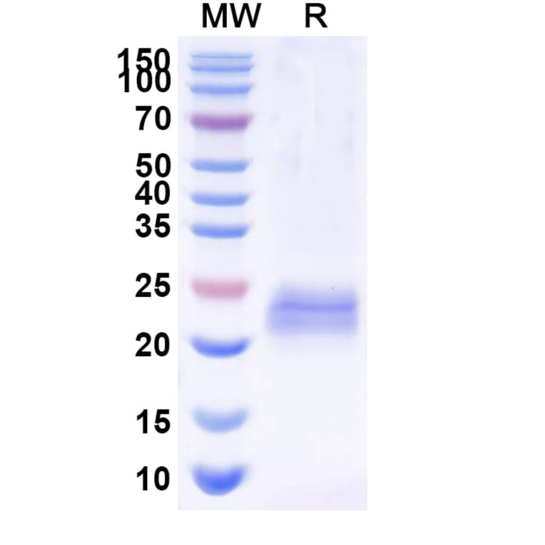 SDS-PAGE - Anti-CD45 Nanobody [2H5] (A338336) - Antibodies.com
