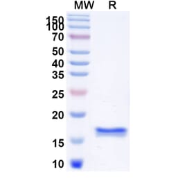 SDS-PAGE - Anti-CD45 Nanobody [2H7] (A338337) - Antibodies.com